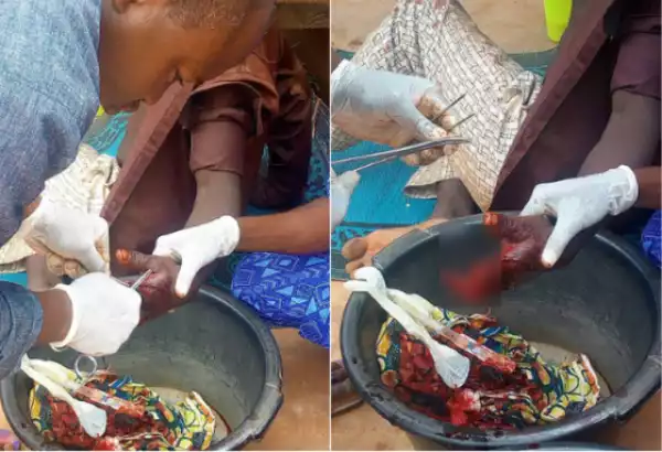 Graphic Photos: Fulanis Cutoff Man’s Fingers After A Cigarette Argument In Niger State